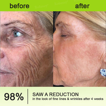 💫Newyuo Botox & Vita-A Retinol Shot Wrinkle-Lift Tightening cream