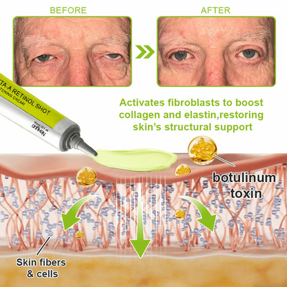 💫Newyuo Botox & Vita-A Retinol Shot Wrinkle-Lift Tightening cream