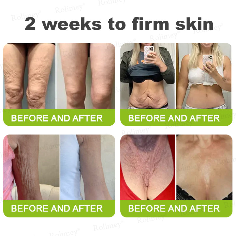 💫Newyuo Botox & Vita-A Retinol Shot Wrinkle-Lift Tightening cream