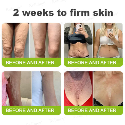 💫Newyuo Botox & Vita-A Retinol Shot Wrinkle-Lift Tightening cream