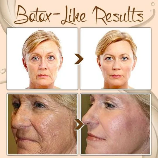 🎁2025 Hot Sale🎁Polypeptide Firming Full Face Cream-CHANGE FOR BEAUTIFUL SKIN WITHIN 2 WEEKS